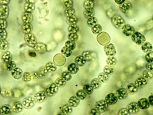 cyanobacteria_microscope_big-cagov waterboards